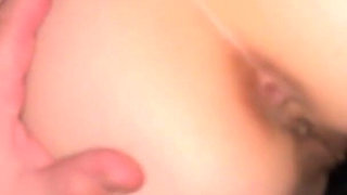 Strange Trends 18 Years Old Girl Got a Tattoo of Dark Anal Pigmentation