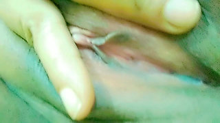 White pussy discharge