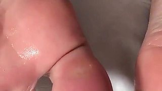 Oily Feet