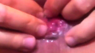Gaping Pussy, Asshole, & Prolapse