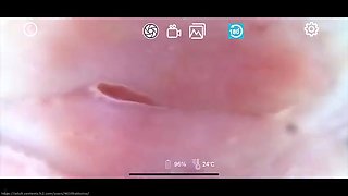 Uncensored And Vaginal Camera 143 Glasses Girl Anna-chans Transparent White Body Is Filled With Plenty Of Cum Glasses Girls Are Cute Too