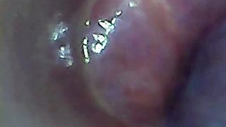Endoscope POV: Test Tube Cock Urethral Insertion