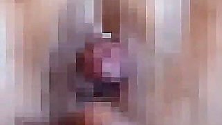 I Aspirate M Woman Clitoris and Am Fixed with Rubber
