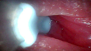 I couldn't believe what happens INSIDE the penis as sperm passes through (endoscopic footage)