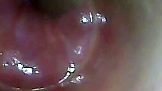 Endoscope POV: Test Tube Cock Urethral Insertion