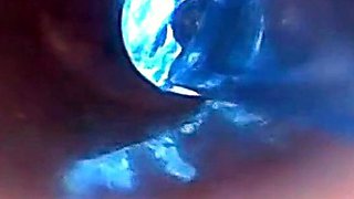 Endoscope POV: Test Tube Cock Urethral Insertion