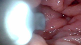 First Time: an Endoscope Reveals the G-spot up Close - Without Mounting!