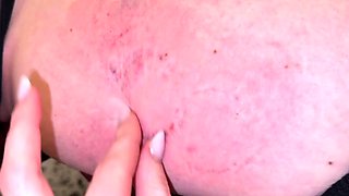 Miss Flora - First Lesbian Thigh Biting Date With Charlee