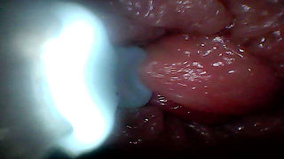 Extreme Proximity Turns Watcher Into Active, Hungry Participant