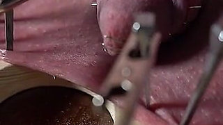 Extreme Corporal Punishment. Needles Nails and Electro