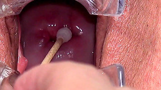 Big Clit Pussy Examined with Speculum