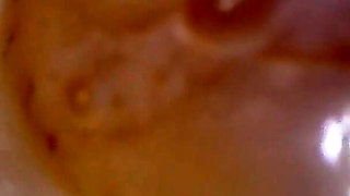 Medical Endoscope Oral Exam: Gummy Chewing, Extreme Teeth & Tongue Macro