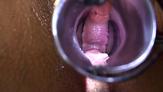 In The Exam Chair She Takes A Speculum And A Relentless Vibrator