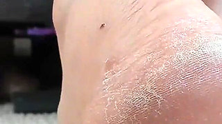 My Dry Feet Heels and Soles