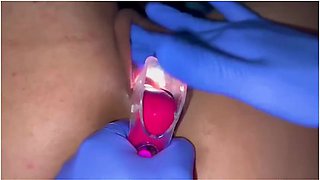 Pussy Care Gynecologist Speculum Examination Brought Me To Orgasm Fluid Examination